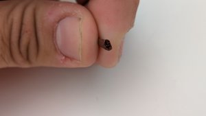 Tooth - Flattened cross-section
