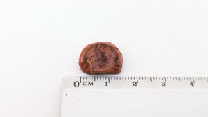 Vertebra, broken - Measurement ~1.5cm