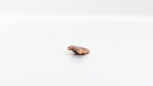 Scale